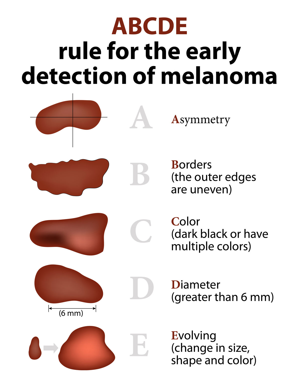 The ABCDE rule for spotting melanoma: asymmetry, border, colour, diameter and evolving, each shown with an example mole.